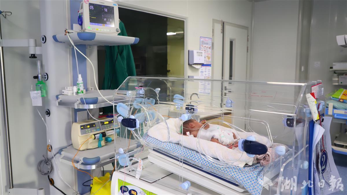 88个日夜的全力救治精心护理 竹山县妇幼保健院成功救治一例800g“巴掌婴儿”