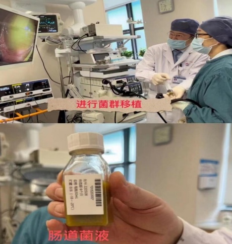 武汉市普仁医院肠道微生态诊疗中心成功实施多例“粪菌移植术”