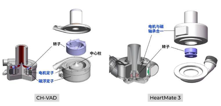 拆解同心医疗：器械出海的终极路标 人工心脏赛道的“百济时刻”(图2)